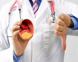 Интернет-опрос